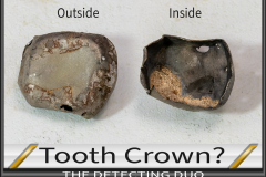Tooth Crown